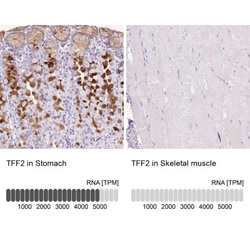 TFF2 Antibody, Novus Biologicals:Antibodies:Primary Antibodies